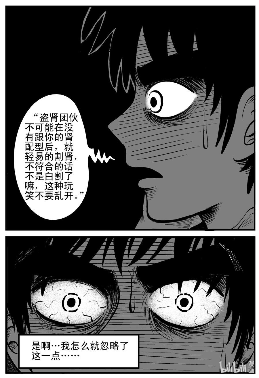 小智怪谈漫画,207 谁偷了我的肾（3）3图