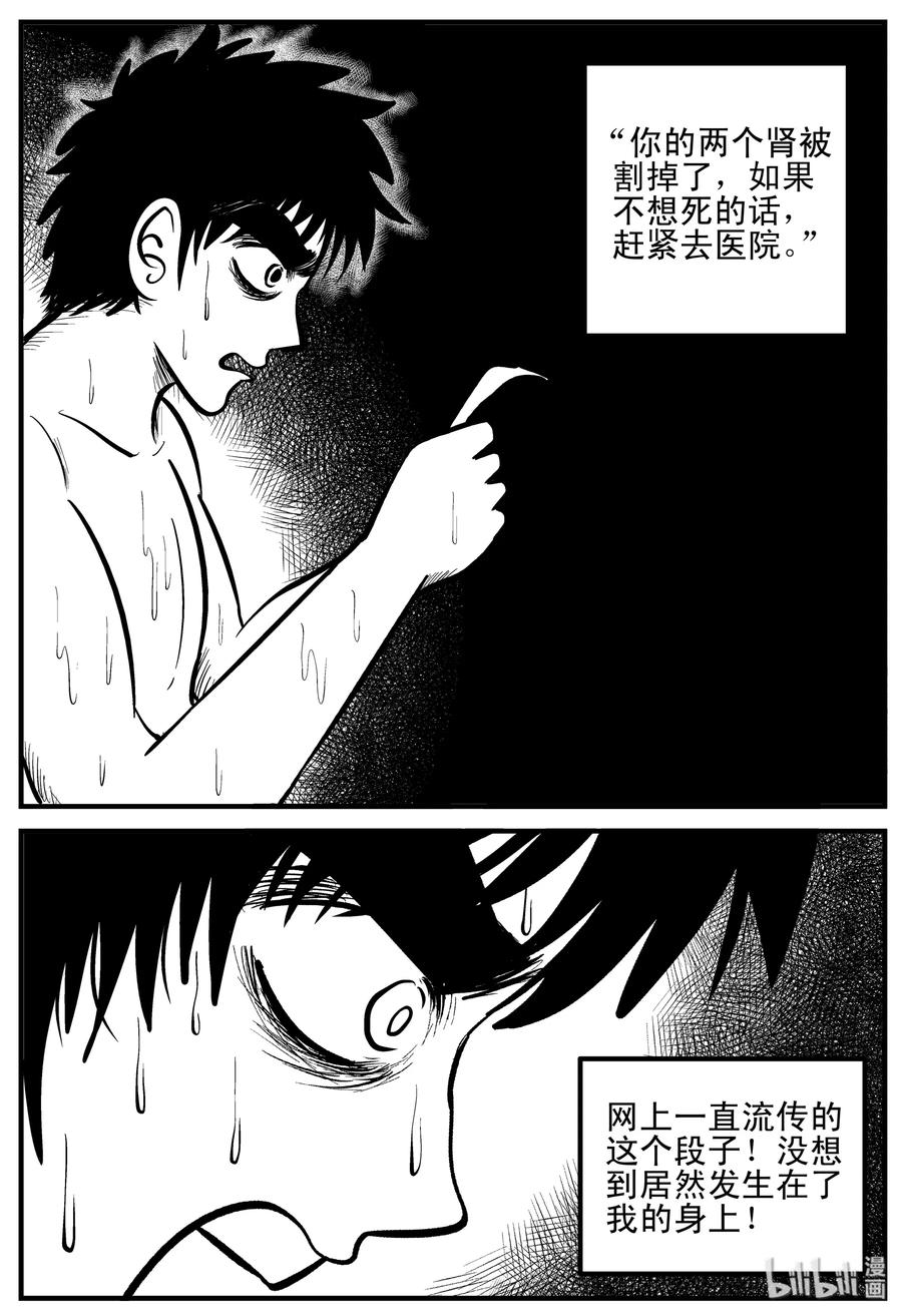 小智怪谈漫画,205 谁偷了我的肾（1）1图