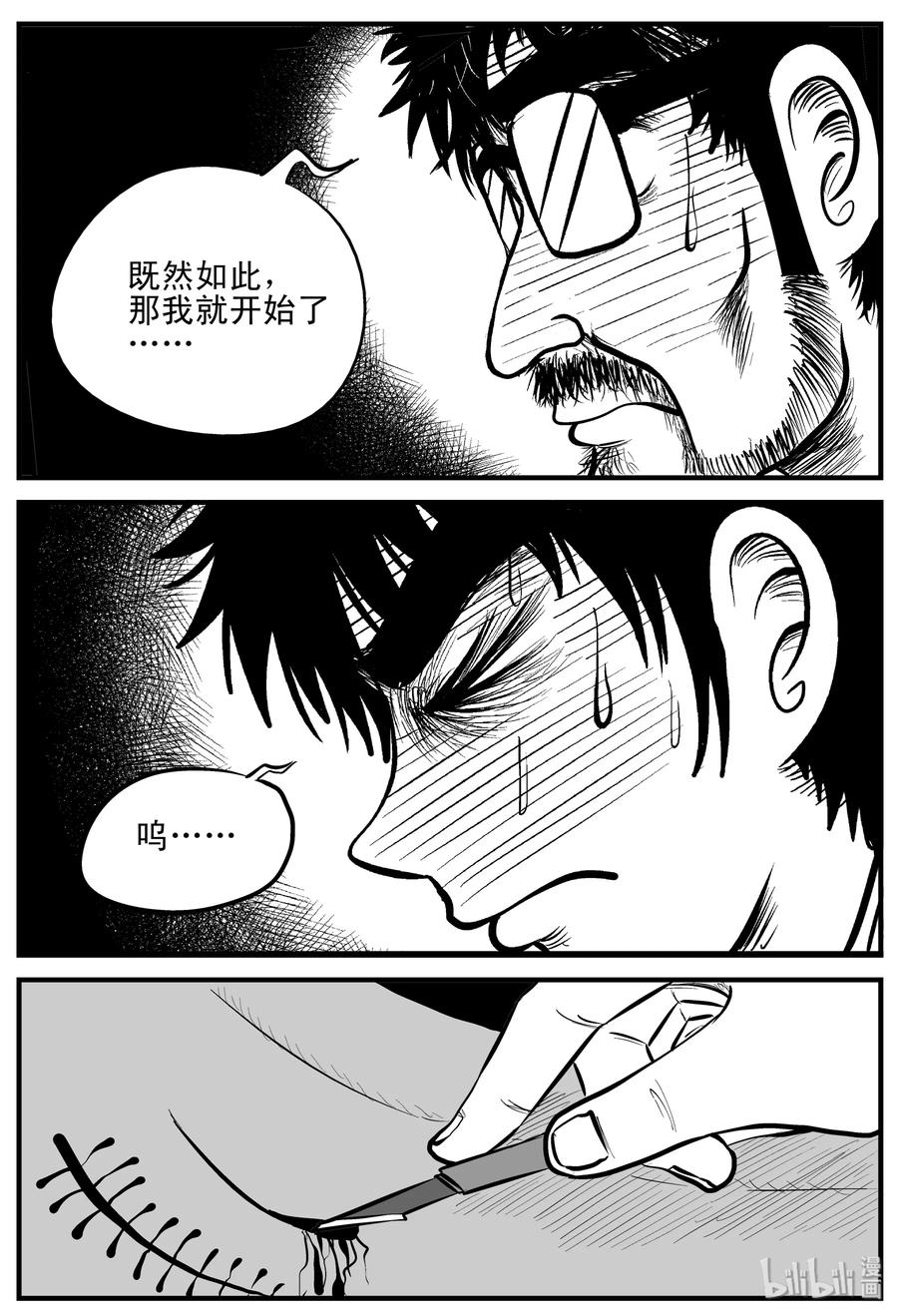 小智怪谈漫画,206 谁偷了我的肾（2）2图