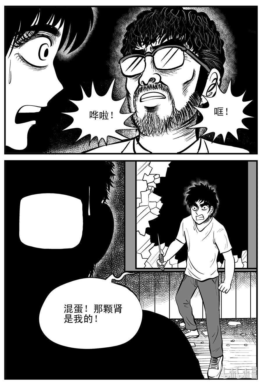 小智怪谈漫画,206 谁偷了我的肾（2）5图